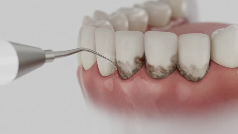 Reliable Dental contractor in Steiner Ranch, TX by Smile Center Dentistry
